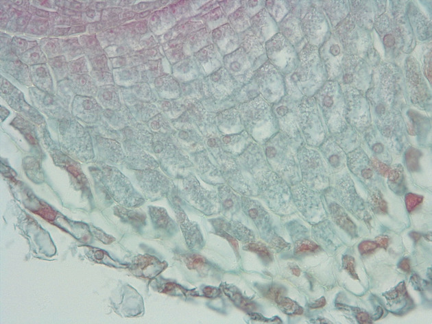 Dicot Root LS Slides - Dicot Root LS 01 400X